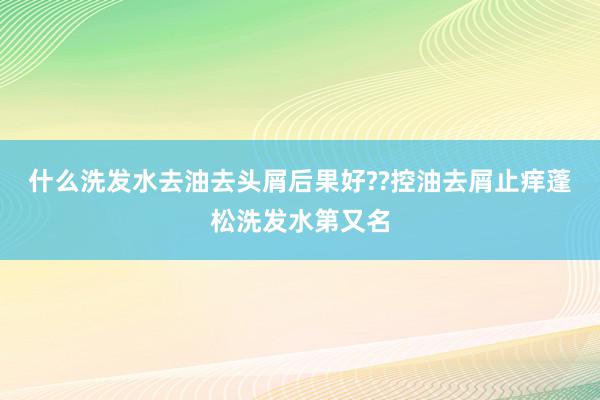 什么洗发水去油去头屑后果好??控油去屑止痒蓬松洗发水第又名